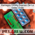 Kamagra 100Mg Examen De La Gelée Orale new03